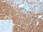 CD45RA/LCA (B-Cell Marker) Antibody in Immunohistochemistry (Paraffin) (IHC (P))