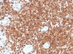 CD45RA/LCA (B-Cell Marker) Antibody in Immunohistochemistry (Paraffin) (IHC (P))
