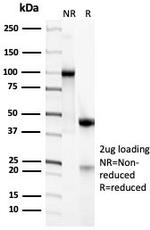 CD45RA/LCA (B-Cell Marker) Antibody in SDS-PAGE (SDS-PAGE)