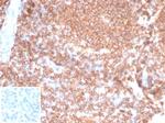 CD45RA/LCA (B-Cell Marker) Antibody in Immunohistochemistry (Paraffin) (IHC (P))