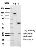 CD45RA/LCA (B-Cell Marker) Antibody in SDS-PAGE (SDS-PAGE)