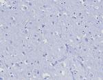 CD45RA/LCA (B-Cell Marker) Antibody in Immunohistochemistry (Paraffin) (IHC (P))