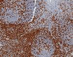 CD45RA/LCA (B-Cell Marker) Antibody in Immunohistochemistry (Paraffin) (IHC (P))