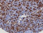 CD45RA/LCA (B-Cell Marker) Antibody in Immunohistochemistry (Paraffin) (IHC (P))