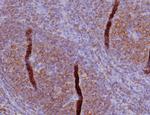 CD45RA/LCA (B-Cell Marker) Antibody in Immunohistochemistry (Paraffin) (IHC (P))