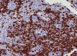 CD45RA/LCA (B-Cell Marker) Antibody in Immunohistochemistry (Paraffin) (IHC (P))