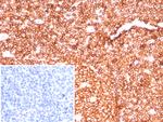 CD45RA/LCA (B-Cell Marker) Antibody in Immunohistochemistry (Paraffin) (IHC (P))