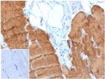 Actin alpha 1, Skeletal Muscle Monoclonal Antibody (ACTA1/360)