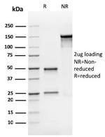 Bax (Apoptosis Marker) Antibody in SDS-PAGE (SDS-PAGE)