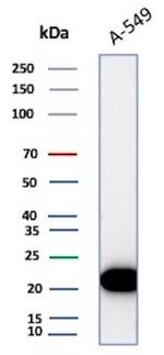 Bax (Apoptosis Marker) Recombinant Mouse Monoclonal Antibody (rBAX/962)