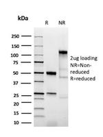 Bax (Apoptosis Marker) Antibody in SDS-PAGE (SDS-PAGE)