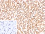 Bax (Apoptosis Marker) Antibody in Immunohistochemistry (Paraffin) (IHC (P))