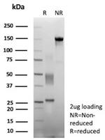 Bax (Apoptosis Marker) Antibody in SDS-PAGE (SDS-PAGE)
