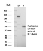 Parvalbumin/PVALB Antibody in SDS-PAGE (SDS-PAGE)