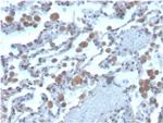 Ras-related C3 botulinum toxin substrate 1 Monoclonal Antibody (CPTC-RAC1-1)