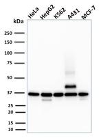 RAD51 (Prognostic and Response to Chemotherapy Marker) Monoclonal Antibody (RAD51/2701)