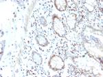 RAD51 Monoclonal Antibody (RAD51, 2702)
