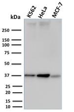 RAD51 (Prognostic and Response to Chemotherapy Marker) Monoclonal Antibody (RAD51/2753)