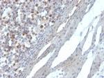 RAD51 Monoclonal Antibody (RAD51, 2856)