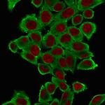 Actin, Smooth Muscle (Leiomyosarcoma Marker) Antibody in Immunocytochemistry (ICC/IF)