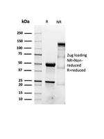 Actin Smooth Muscle (Leiomyosarcoma Marker) Antibody in Immunoelectrophoresis (IE)