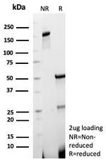 ACE2/Angiotensin I Converting Enzyme 2 Antibody in SDS-PAGE (SDS-PAGE)