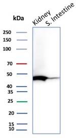 ACE2/Angiotensin I Converting Enzyme 2 Antibody in Western Blot (WB)