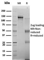 RBMS2/SCR3 Antibody in SDS-PAGE (SDS-PAGE)
