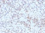 Retinol Binding Protein-1 (RBP1) Recombinant Mouse Monoclonal Antibody (rRBP1, 872)