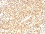 Cyclin D1 (G1-Cyclin and Mantle Cell Lymphoma Marker) Antibody in Immunohistochemistry (Paraffin) (IHC (P))