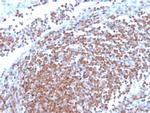 Cyclin D1 Antibody in Immunohistochemistry (Paraffin) (IHC (P))
