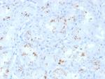RBP4/Retinol Binding Protein 4 Monoclonal Antibody (RBP4/4050)