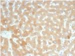 RBP4/Retinol Binding Protein 4 Recombinant Rabbit Monoclonal Antibody (RBP4/7045R)