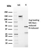 Bcl-2 Antibody in SDS-PAGE (SDS-PAGE)