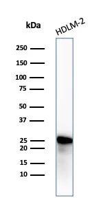 Bcl-2 Antibody in Western Blot (WB)