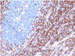 Bcl-2 Antibody in Immunohistochemistry (Paraffin) (IHC (P))