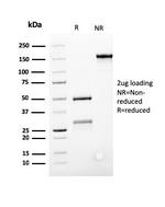 Bcl-2 (Apoptosis and Follicular Lymphoma Marker) Antibody in SDS-PAGE (SDS-PAGE)