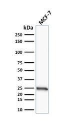 Bcl-2 (Apoptosis and Follicular Lymphoma Marker) Antibody in Western Blot (WB)