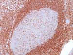 Bcl-2 (Apoptosis and Follicular Lymphoma Marker) Antibody in Immunohistochemistry (Paraffin) (IHC (P))
