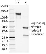 Bcl-2 (Apoptosis and Follicular Lymphoma Marker) Antibody in SDS-PAGE (SDS-PAGE)