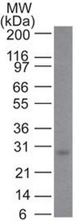 Bcl-2 (Apoptosis and Follicular Lymphoma Marker) Antibody in Western Blot (WB)