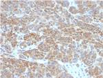 Bcl-2 (Apoptosis and Follicular Lymphoma Marker) Monoclonal Antibody (BCL2/782)