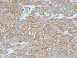 Bcl-2 (Apoptosis and Follicular Lymphoma Marker) Antibody in Immunohistochemistry (Paraffin) (IHC (P))