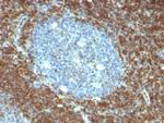 Bcl-2 (Apoptosis and Follicular Lymphoma Marker) Antibody in Immunohistochemistry (Paraffin) (IHC (P))