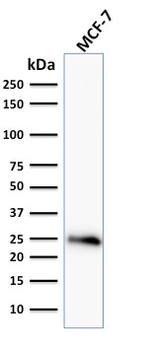 Bcl-2 (Apoptosis and Follicular Lymphoma Marker) Antibody in Western Blot (WB)