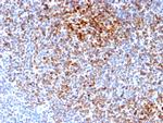 Bcl-2 Recombinant Rabbit Monoclonal Antibody (BCL2, 2210R)
