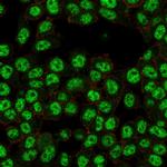 NF-kB p65/RELA Antibody in Immunocytochemistry (ICC/IF)