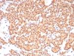 RET Proto-oncogene Monoclonal Antibody (RET/8790)
