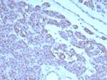 RET Proto-oncogene Antibody in Immunohistochemistry (Paraffin) (IHC (P))