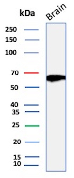 RET Proto-oncogene (Medullary Thyroid Carcinoma Marker) Antibody in Western Blot (WB)